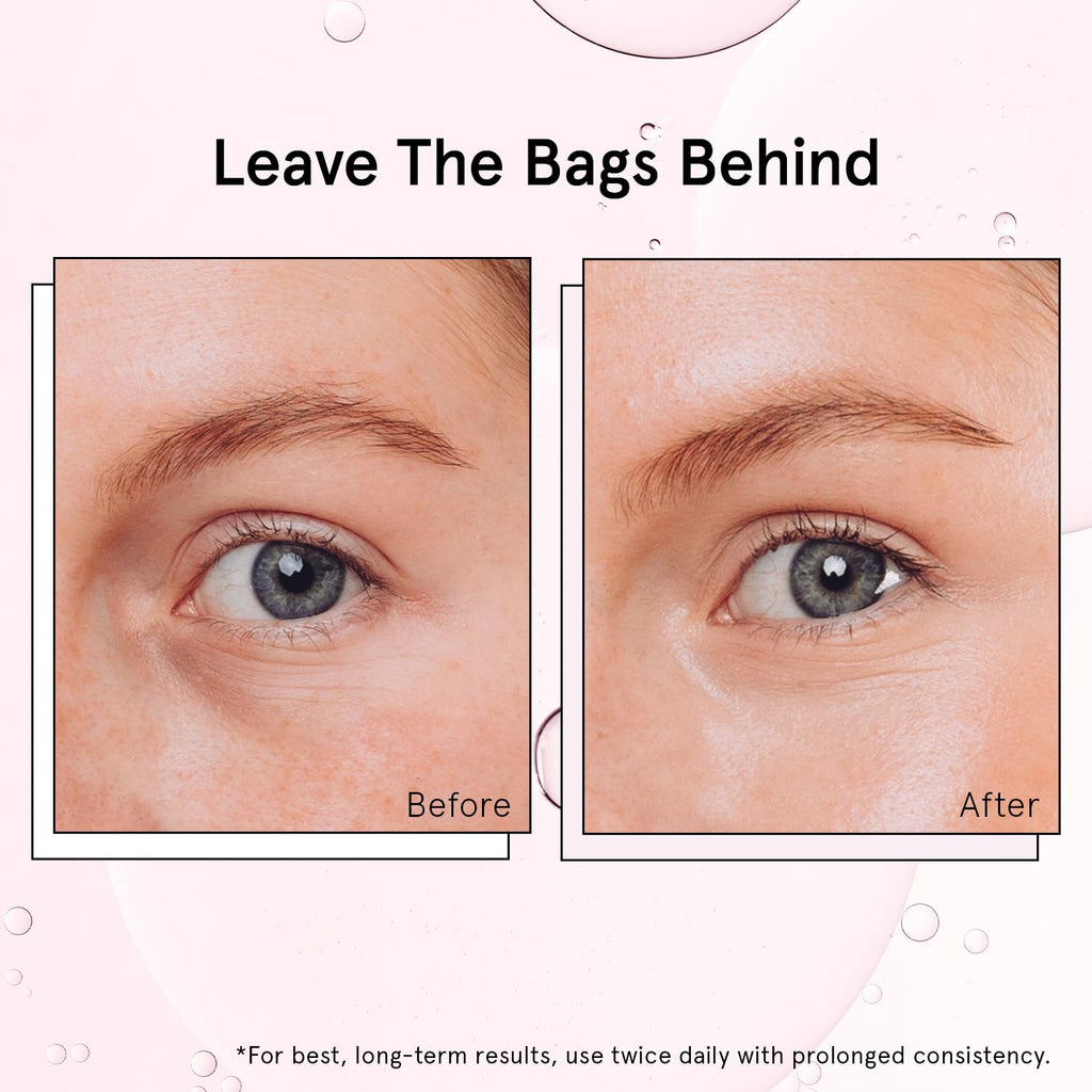 grace & stella Under Eye Brightener Roller - Airplane Travel Essentials - Travel Size Toiletries - Retinol & Caffeine Eye Serum for Puffiness, Dark Circles, Wrinkles - Vegan Skincare (15ml / 0.51floz)