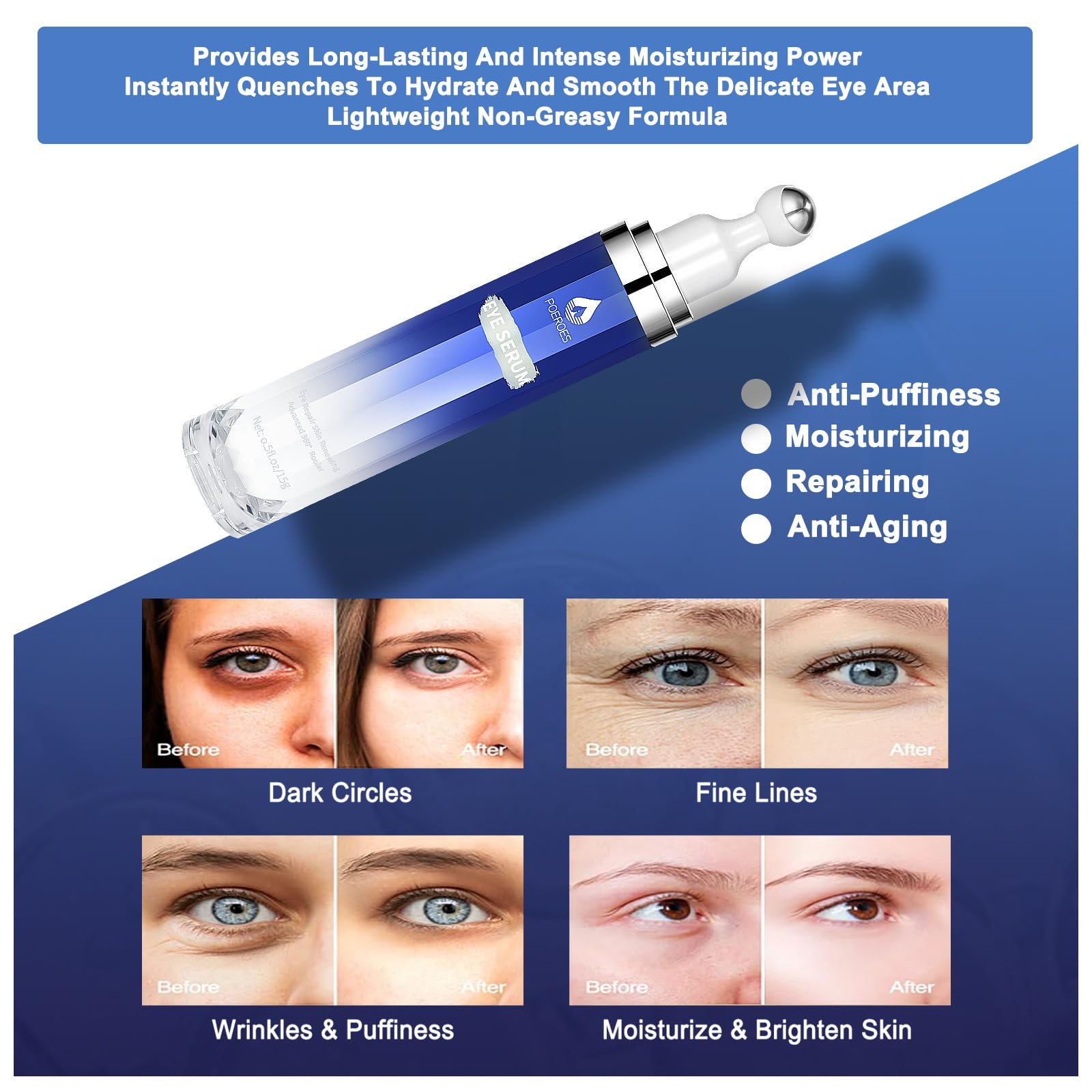 Eye Serum with 8% Caffeine 8% Retinol Hyaluronic Acid Niacinamide peptides for Puffy Bags Fine Lines Dark Circles Wrinkles, Under Eye Cream with 360° Roller Massage Ball, 0.5 fl. oz